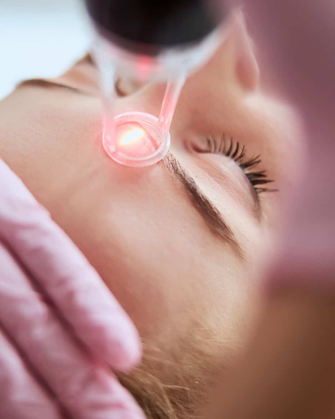 Why We Combine Laser Treatments with Cosmetic Facial Procedures