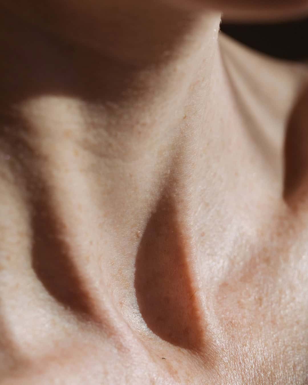 How Long Does It Take To Heal From Neck Lift Surgery?