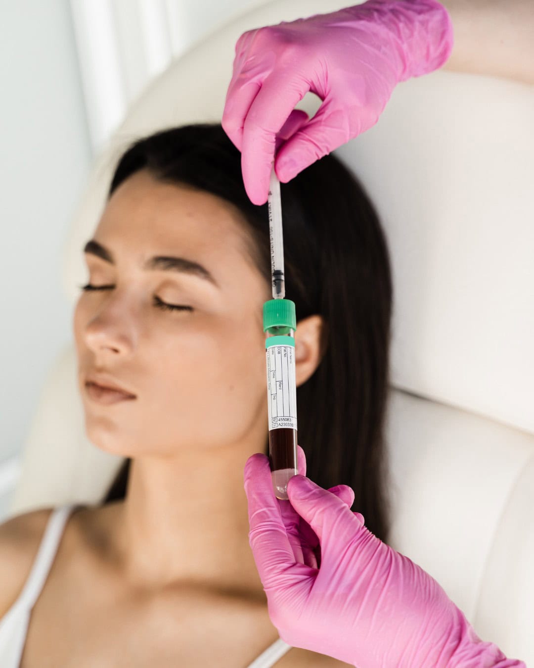 A Natural Alternative to Fillers? How PRP Treatments Treat Fine Lines &amp; Wrinkles Naturally